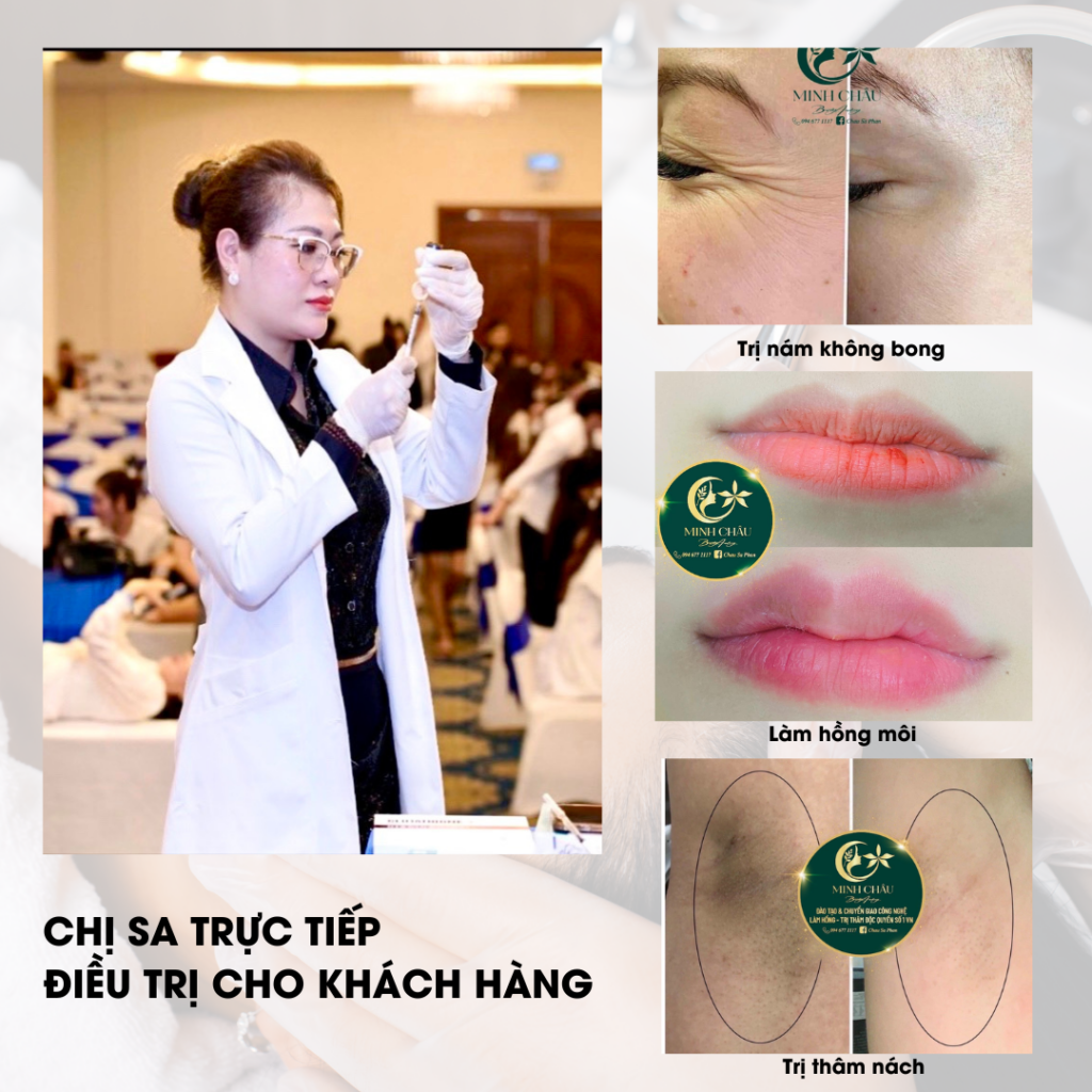 Một số hình ảnh các ca điều trị của khách hàng tại Minh Châu Beauty 